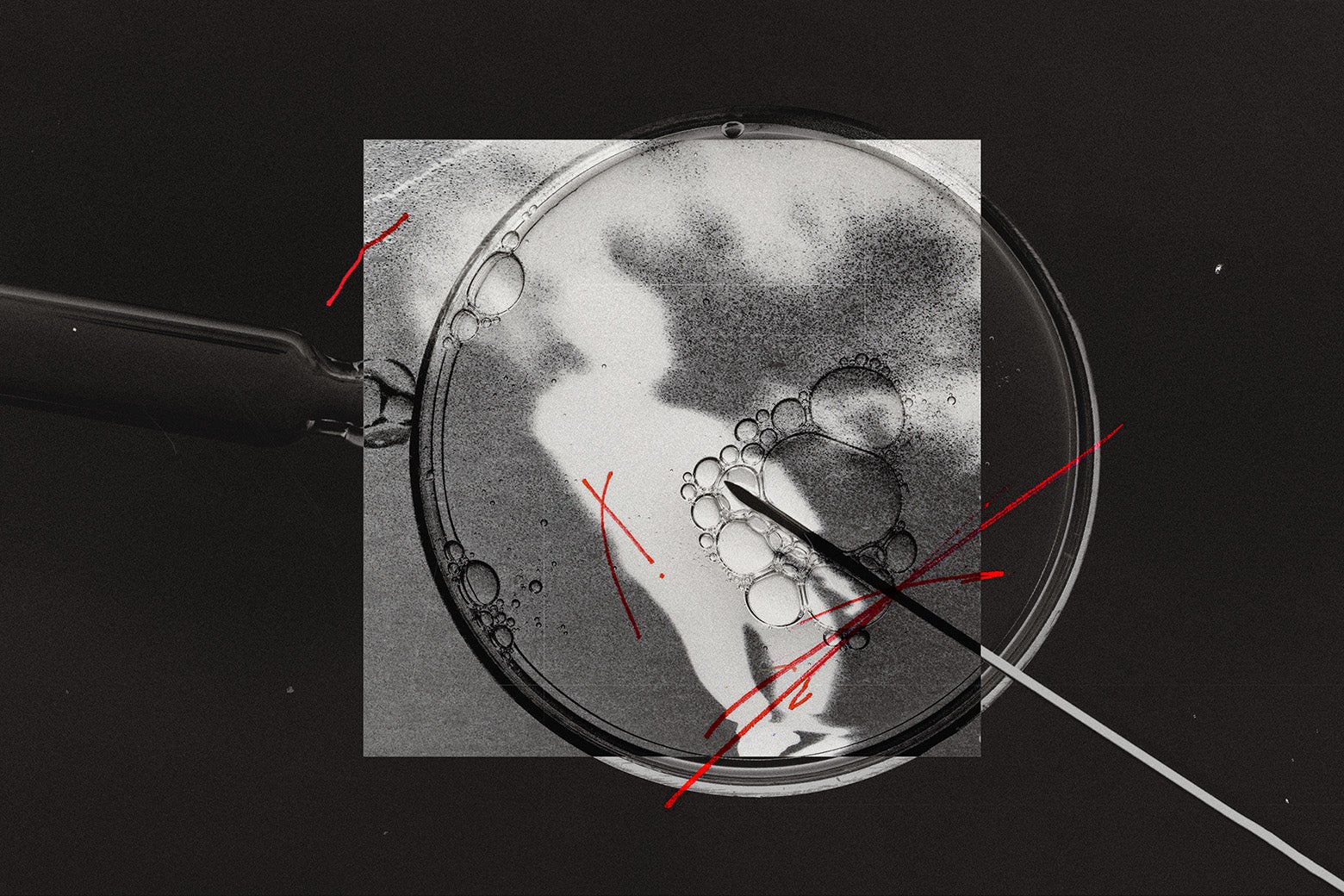 The IVF Ruling Is About Who Gets to Raise Your Children