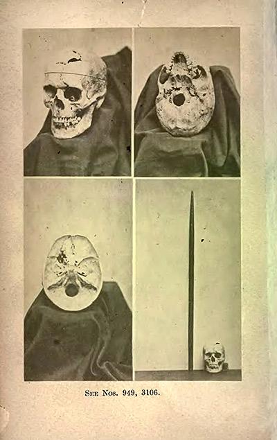 Frontispiece, showing multiple views of Gage's exhumed skull, and tamping iron, 1870.