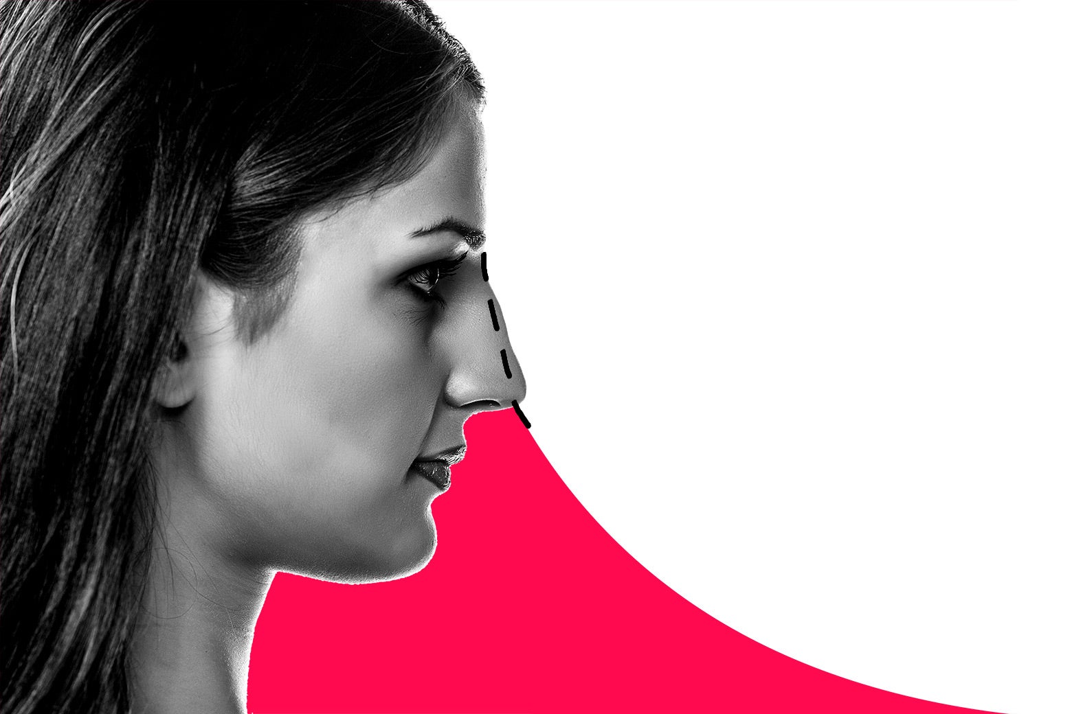 My mother is pressuring me to undergo cosmetic procedures, and more advice from Dear Prudie. - Vimarsana News