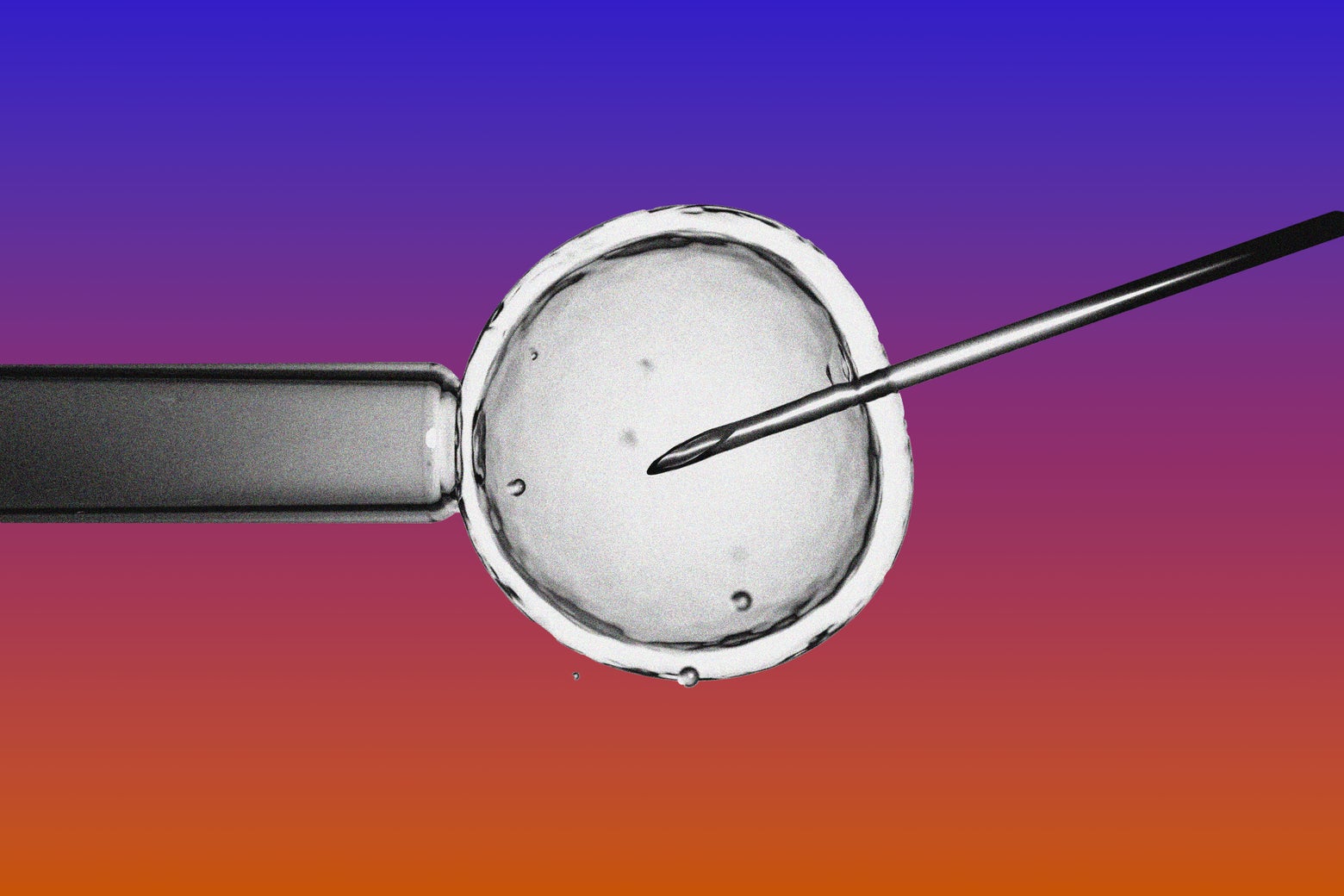 How IVF Became the GOP&rsquo;s Next Battle