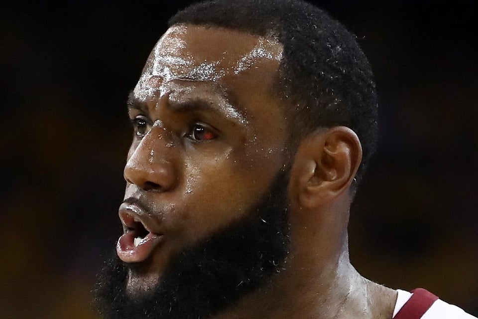 LeBron James' left eye looks very red and gross.