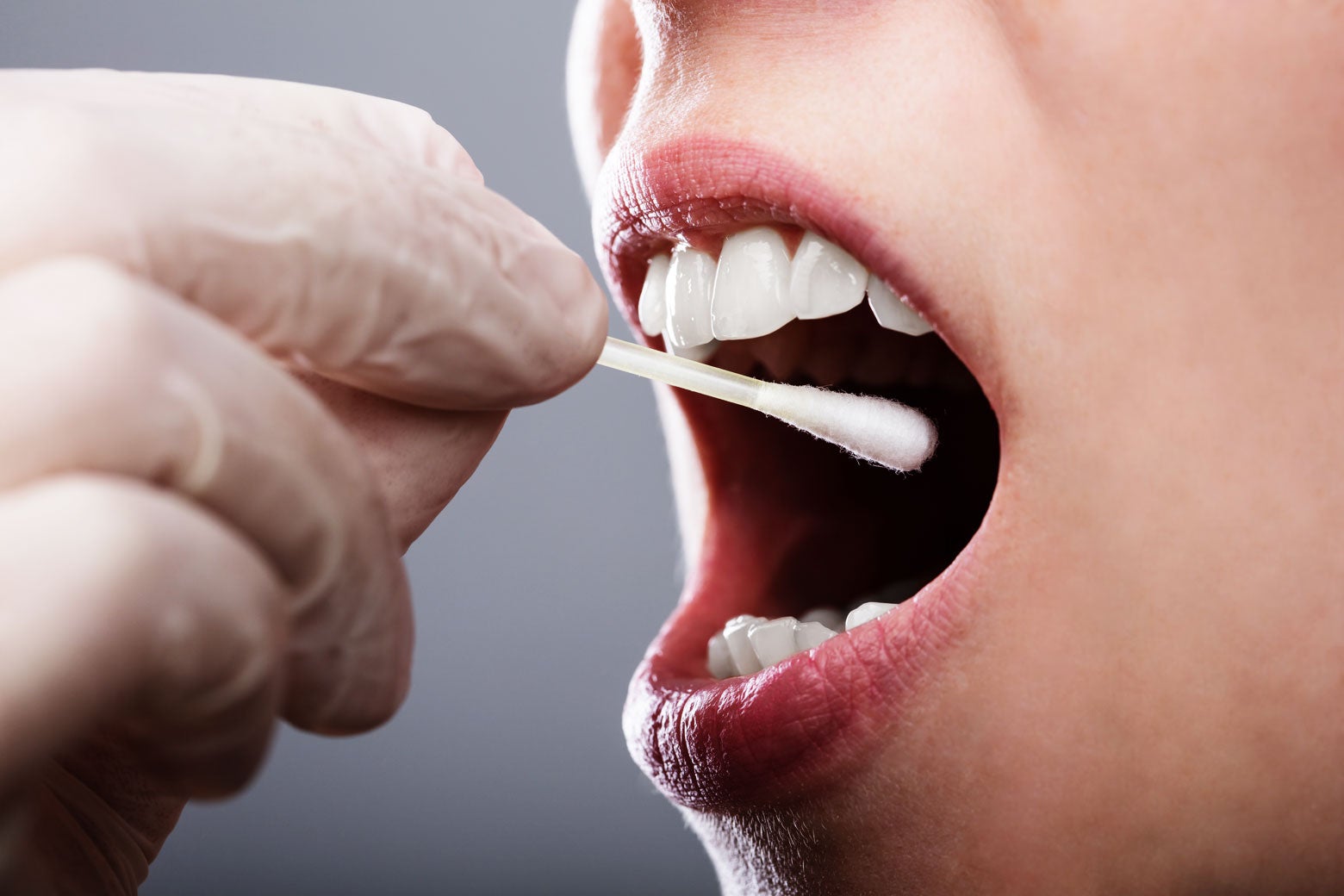 Stock image of a gloved hand directing a cotton swab into a person's open mouth for a DNA swab.