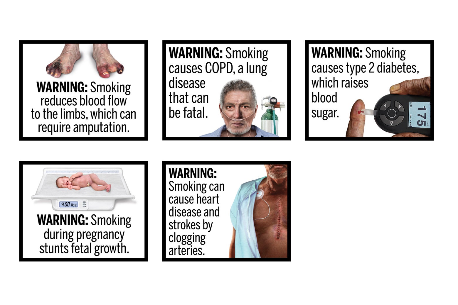 The next five images in the series of 11 uncommon smoking side effects, including "Smoking during pregnancy stunts fetal growth," along with a thumbnail image of a small infant on a scale.