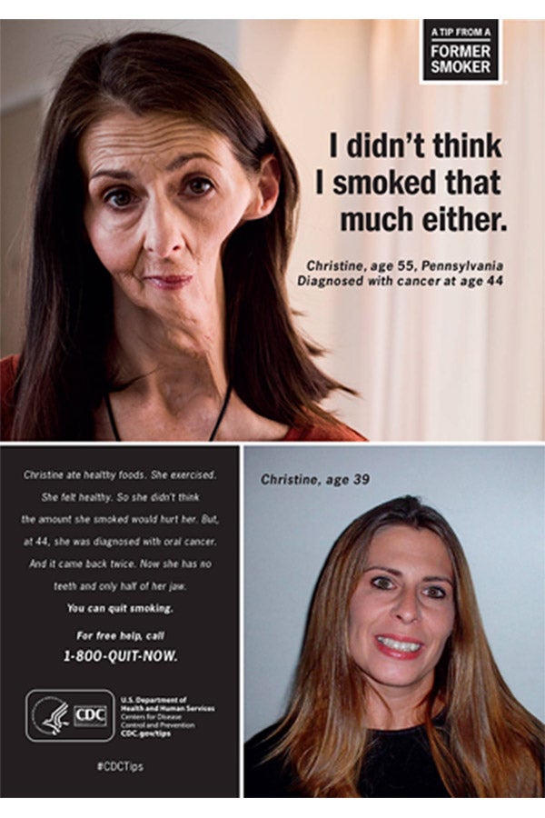 A woman with half of her jaw removed from smoking.