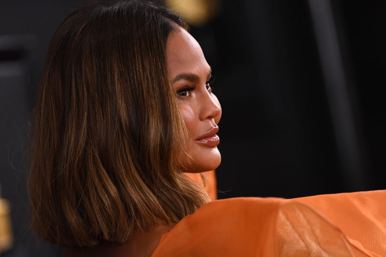 Chrissy Teigen's photos of her pregnancy loss are common, according to two grief photographers.
