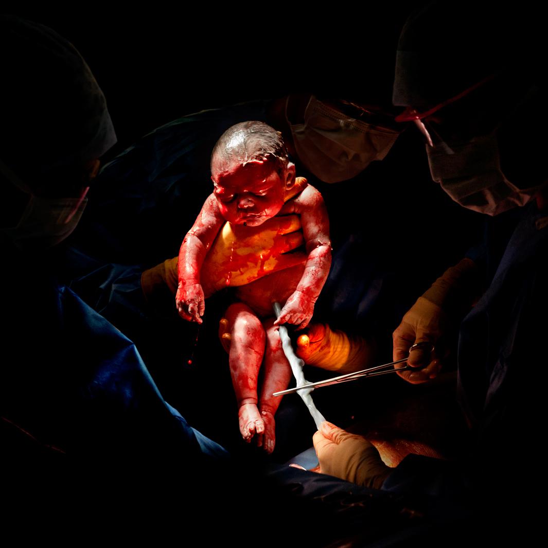 CAESAR #2Liza - born February 26, 2013 at 8:45 am 3kg 200 - 3 seconds of life