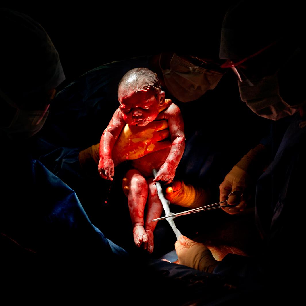 CAESAR #2Liza - born February 26, 2013 at 8:45 am 3kg 200 - 3 seconds of life