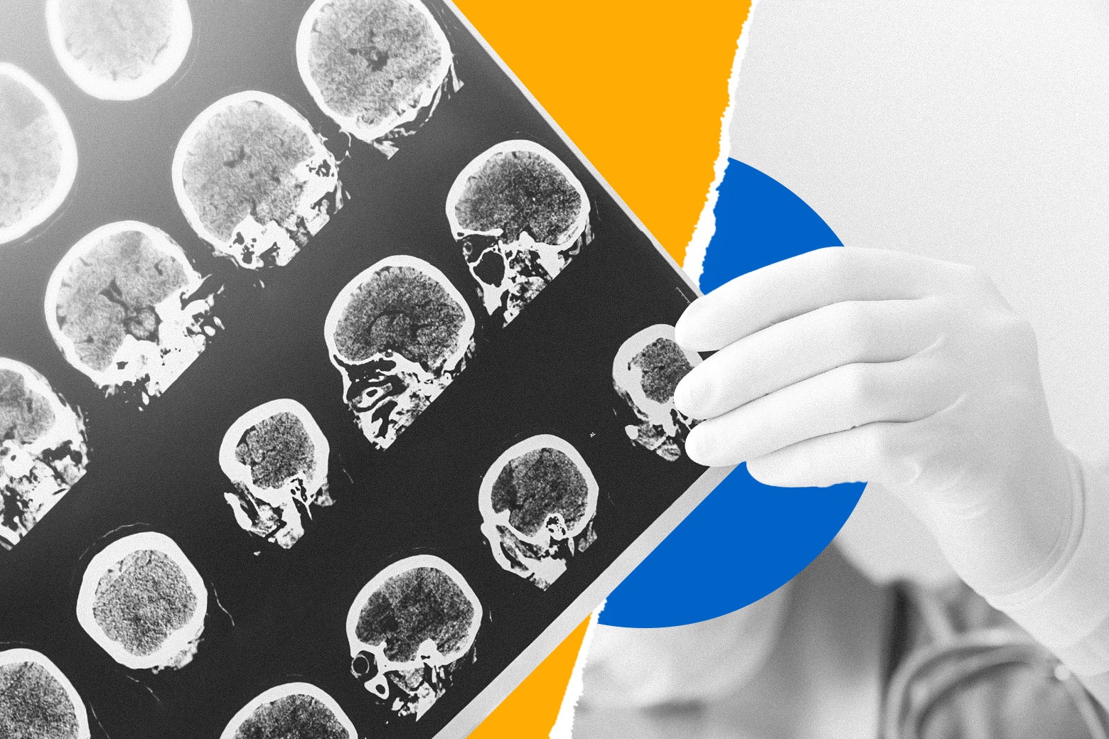 Can We Make an Alzheimer&rsquo;s Drug That Works?