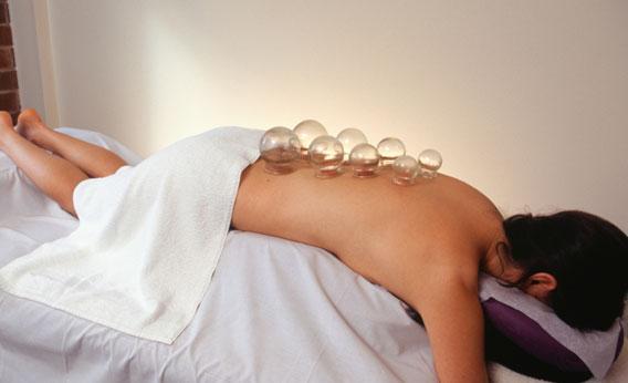 Woman lying face down having cupping acupuncture.