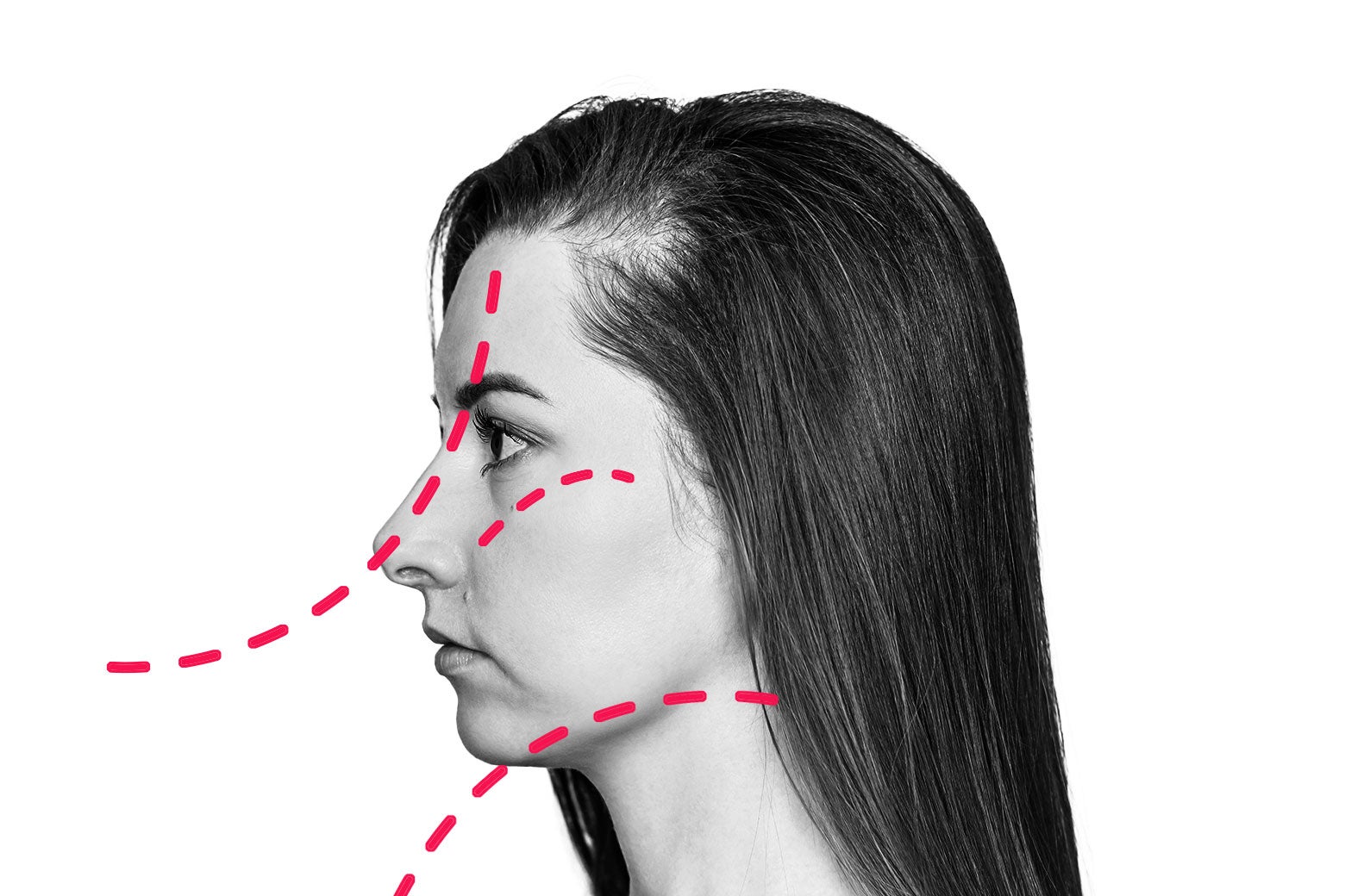 Help! I Think My Friend Would Highly Benefit from Plastic Surgery—And It’s My Duty to Tell Her.