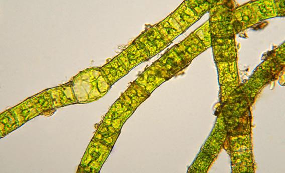 Filamentous green algae.