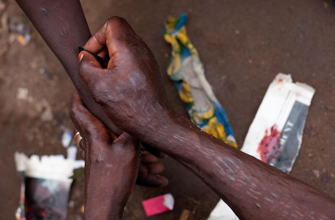 Lagos, Nigeria- Small cuts are made on the striking arm and a mixture of marijuana and other herbs blessed in the north by a malam, an Islamic healer, are rubbed into the cut to provide protection and strength.