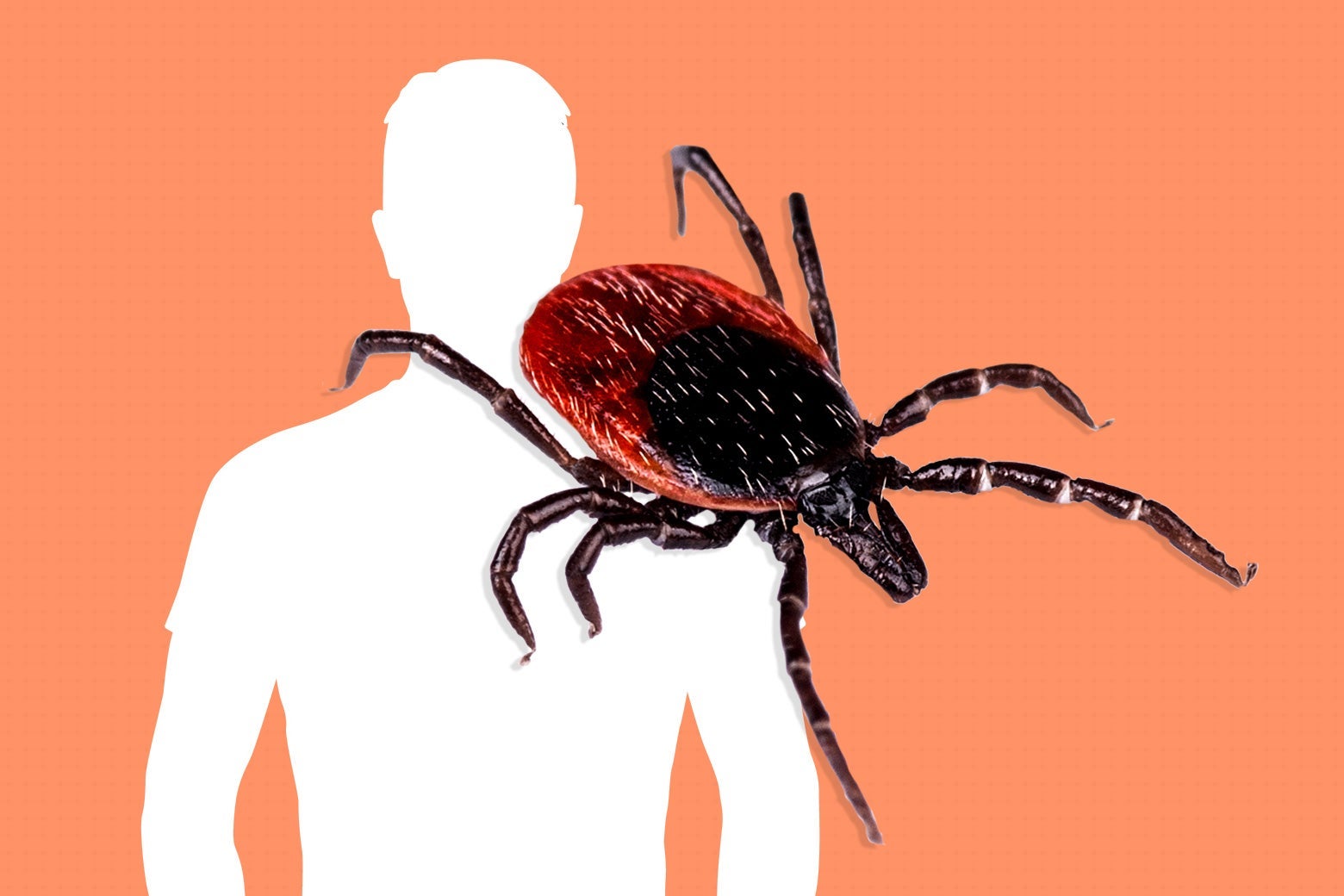 Ross Douthat, Conservative Pundit, Is Actually Exactly What the Chronic Lyme &ldquo;Debate&rdquo; Needs