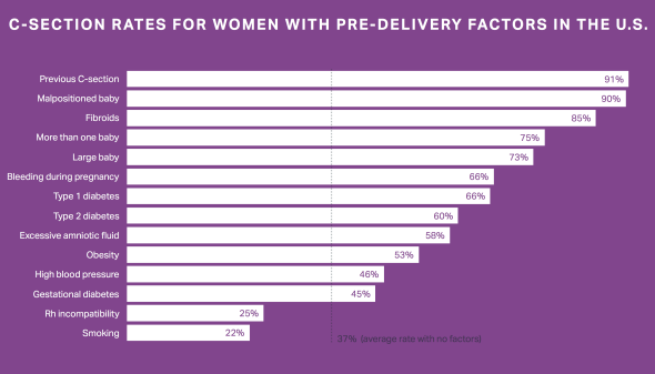 Where C-sections are most common in the U.S. and why they're