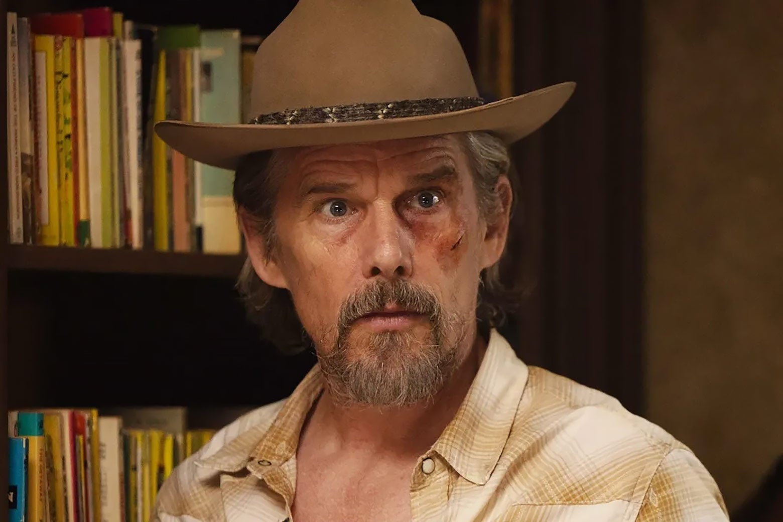 A middle-aged man wearing a cowboy hat and with a bruise on his face looks shocked.