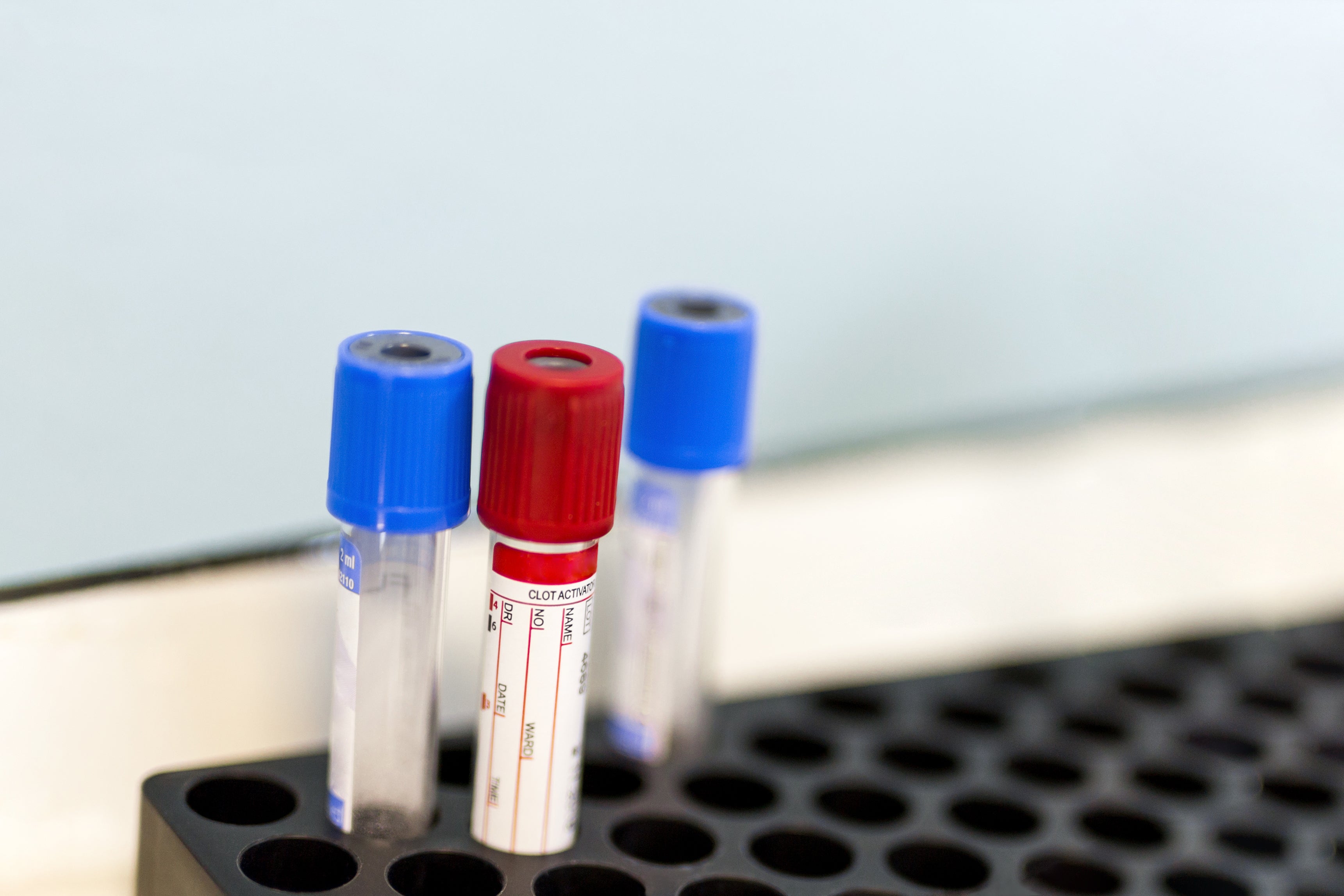 Three laboratory blood analysis tubes.