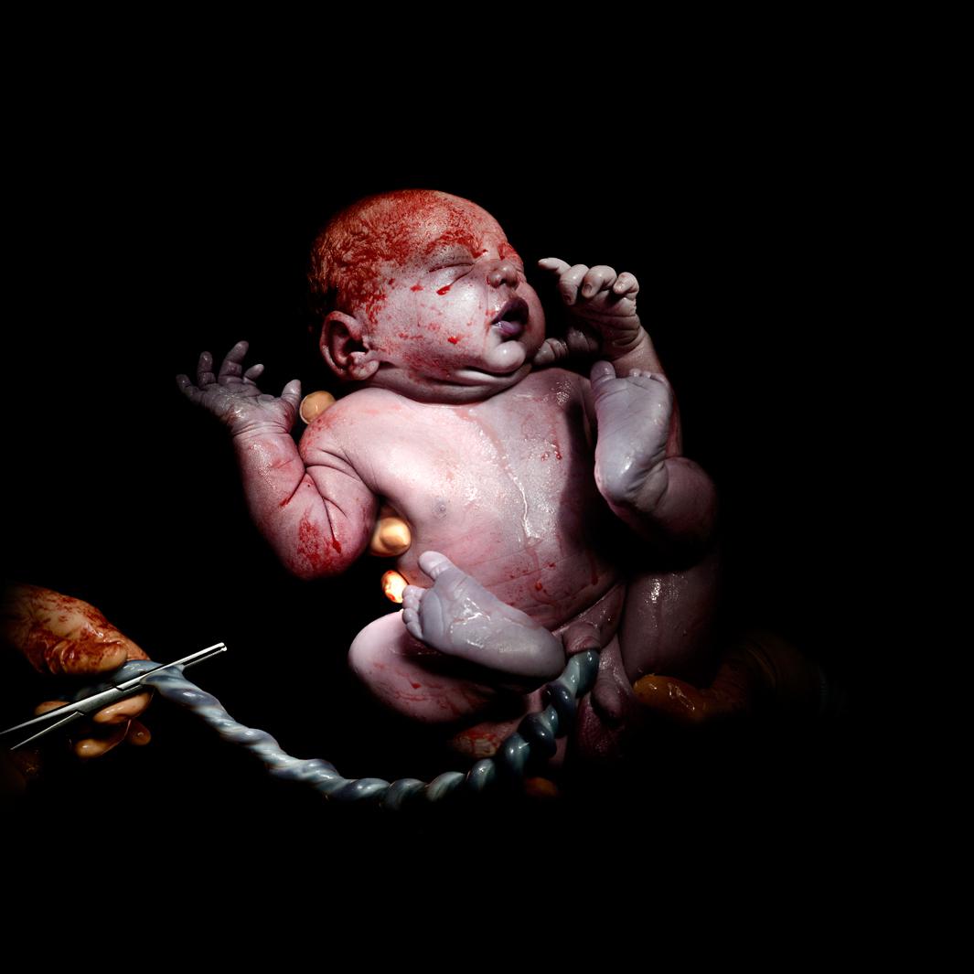 CAESAR #13Kevin - born December 27, 2013 at 10:36 4kg 366 - 13 seconds of life