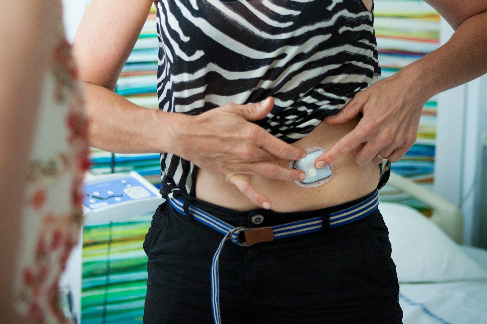 A person with their shirt pulled up to show off an insulin pump against her stomach.