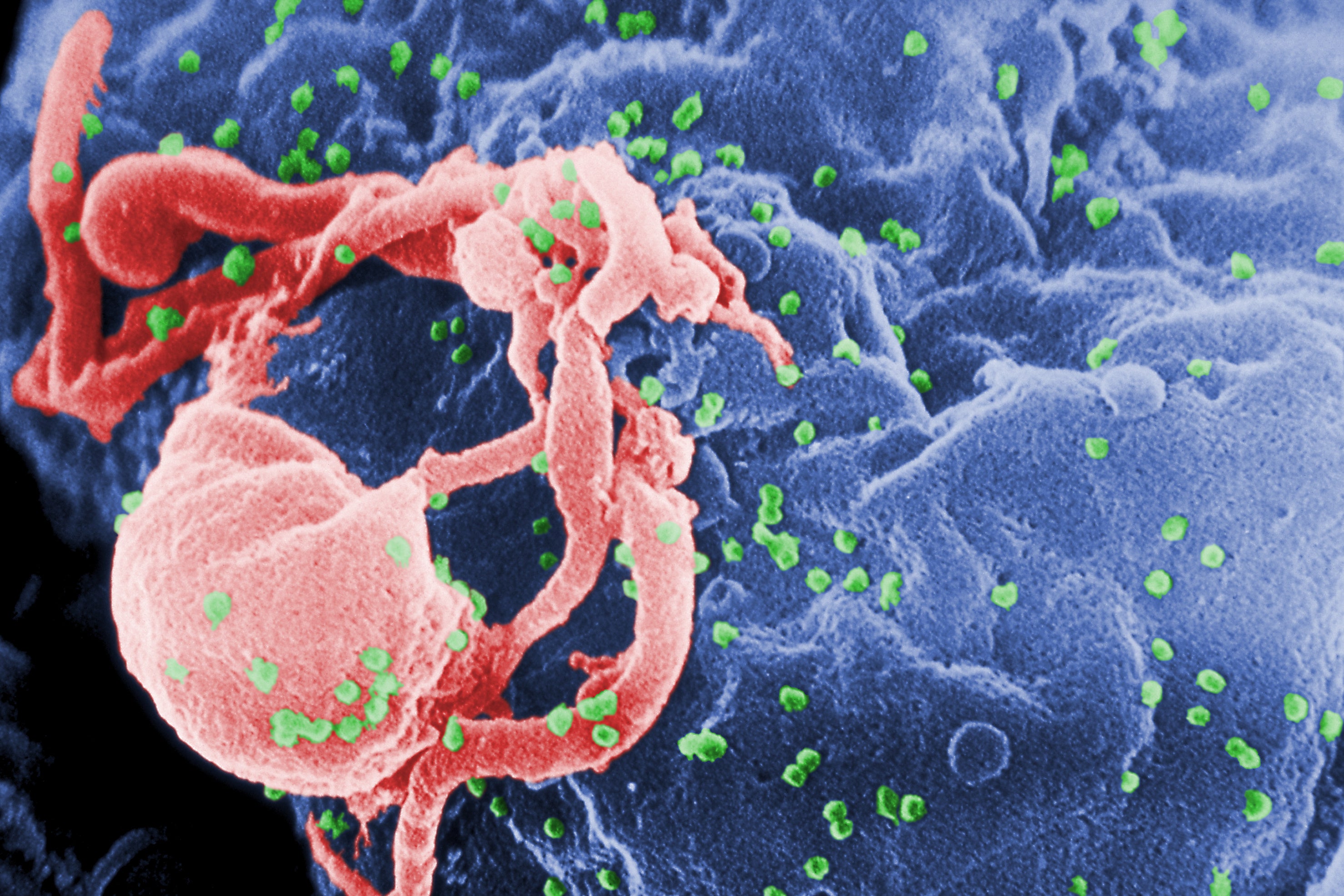 HIV virions budding from a cultured human lymphocytes.