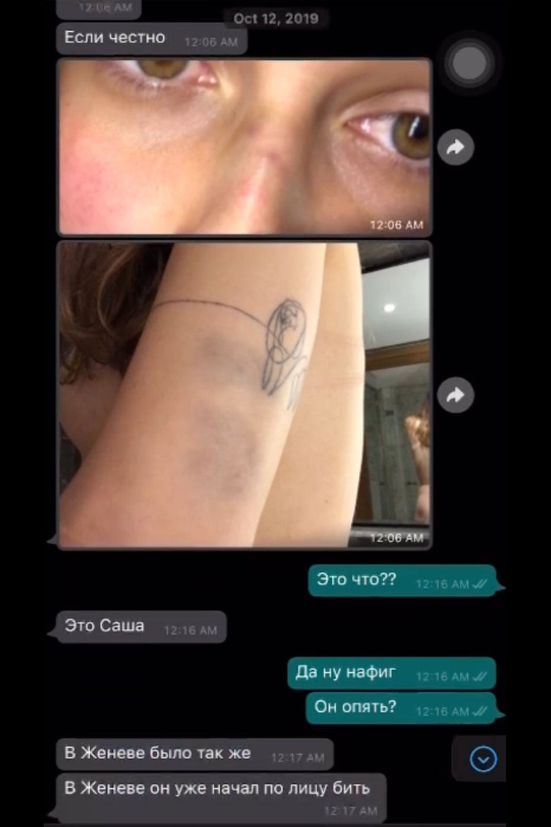 Text message exchange with photos sent from Sharypova of bruises on her face and forearm