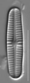 A diatom