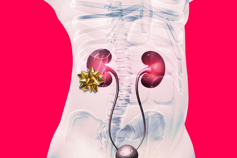 An image of the kidneys with a gold gift bow on one of them.