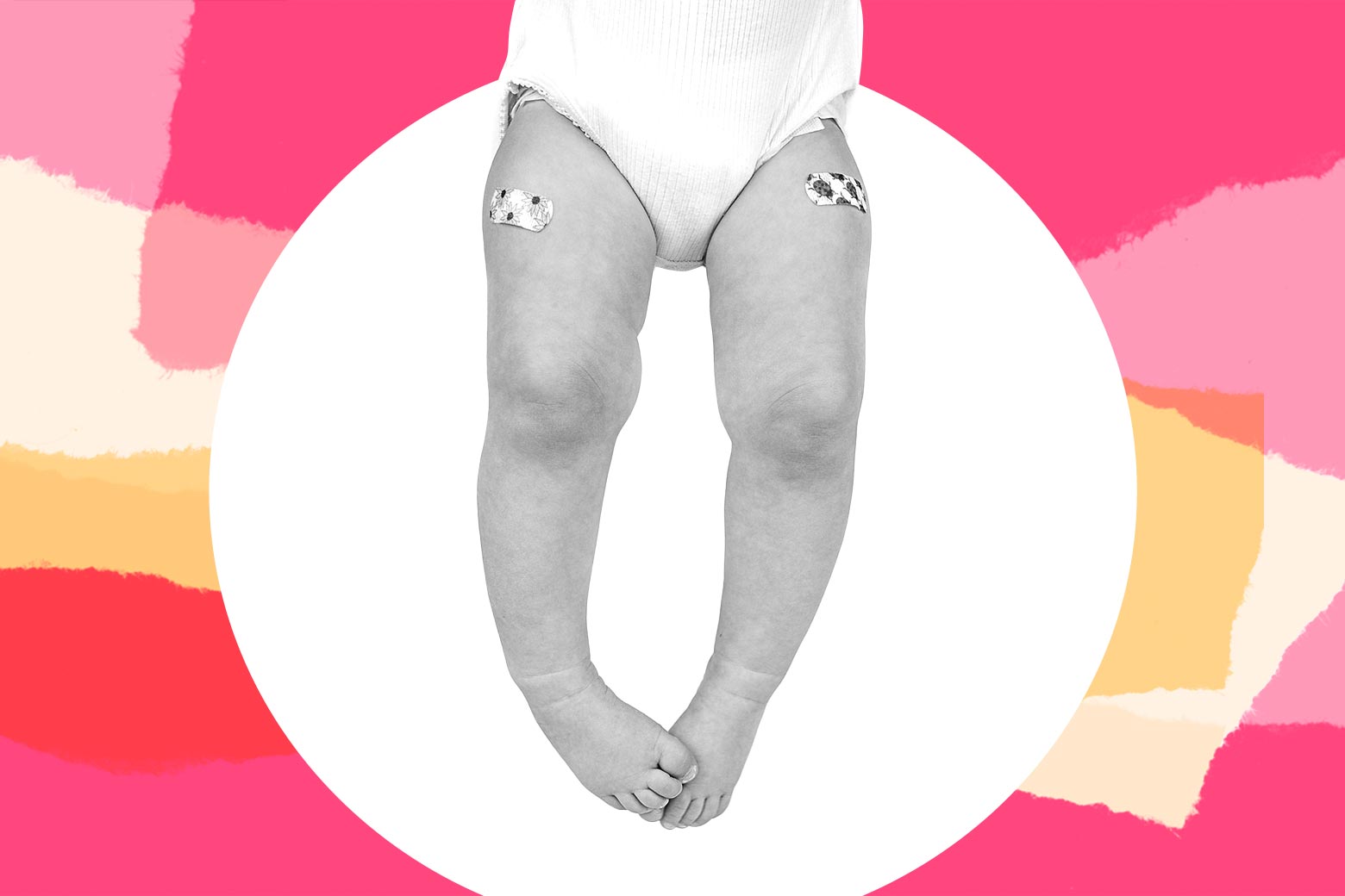 A baby with two bandaids on her legs, as if for after vaccinations.