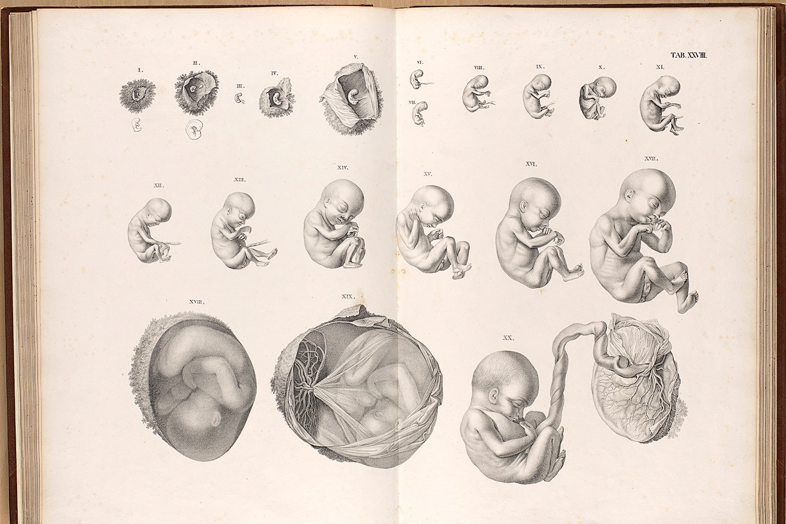 Developmental stages of a human embryo to a full-term fetus. 
