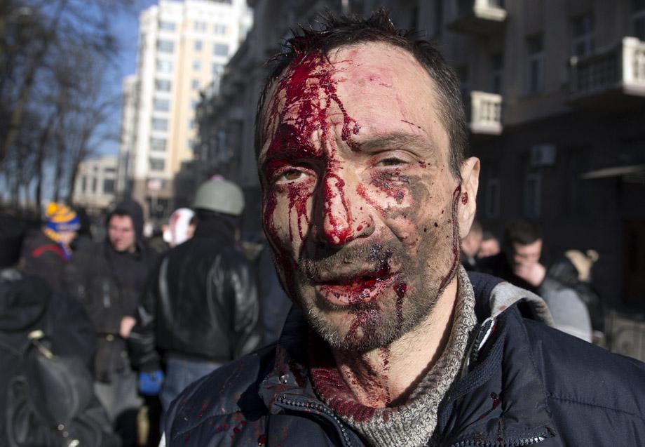  A man injured in clashes between protesters and government police in Kiev on Feb. 18, 2014. 