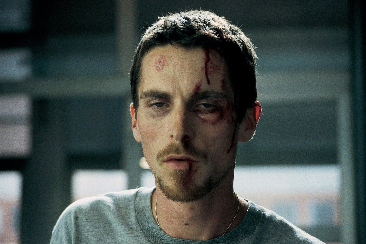 A medium close-up of an emaciated Christian Bale with scars and bruises all over his face staring ahead in a daze.