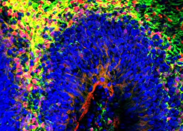 When suspended in culture, human stem cells may develop into miniature brains with distinct layers.