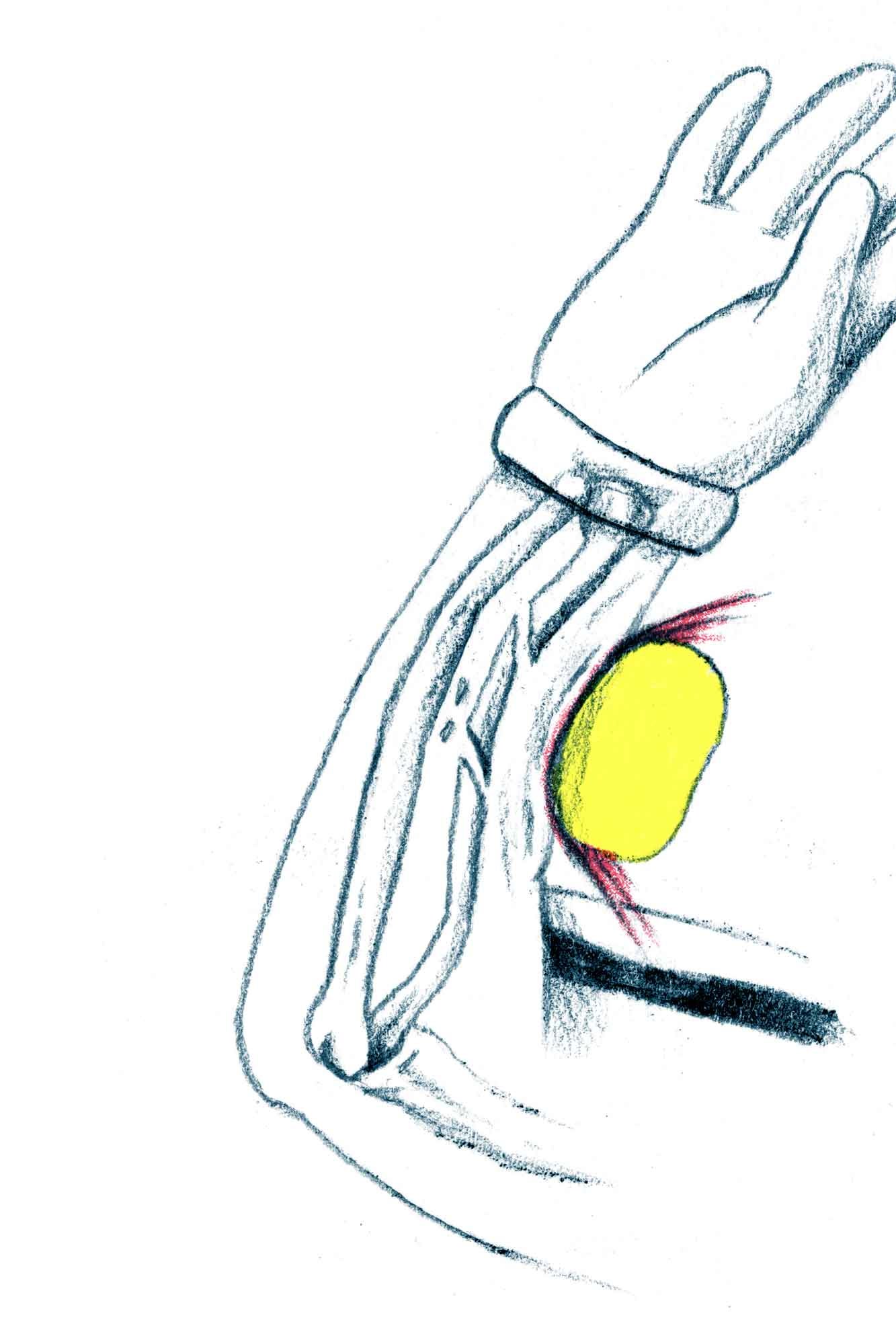 FogoTennis ball striking the arm.