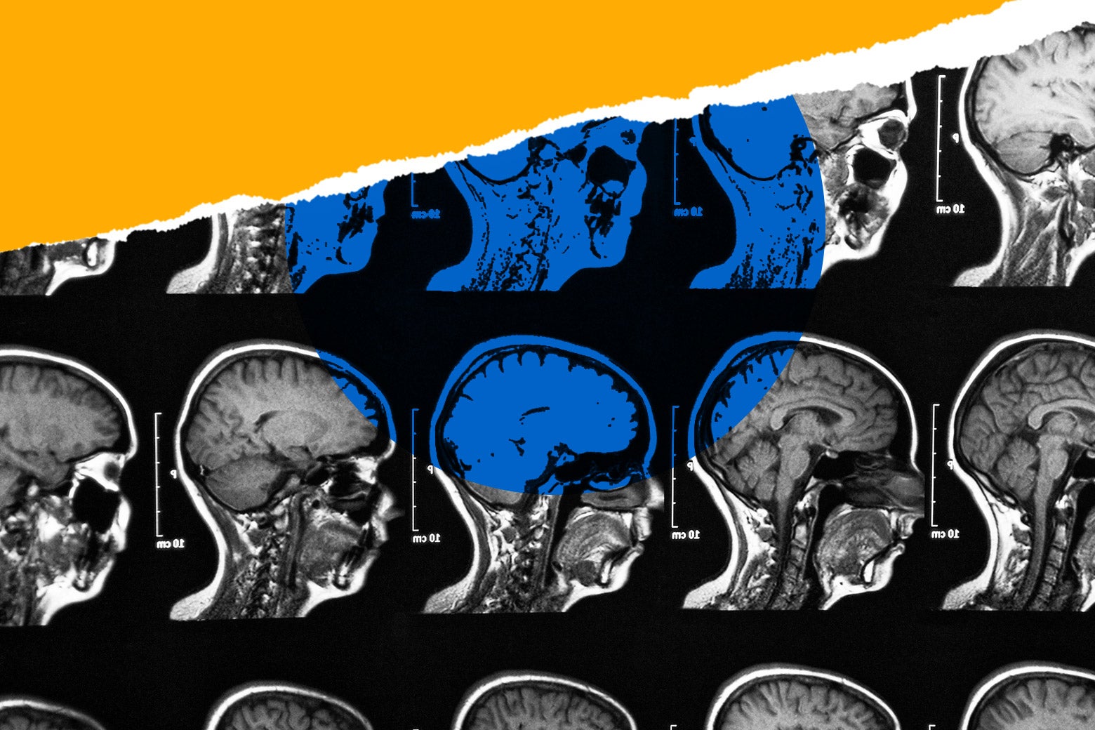 Is a 25-Year-Old&rsquo;s Brain Mature?