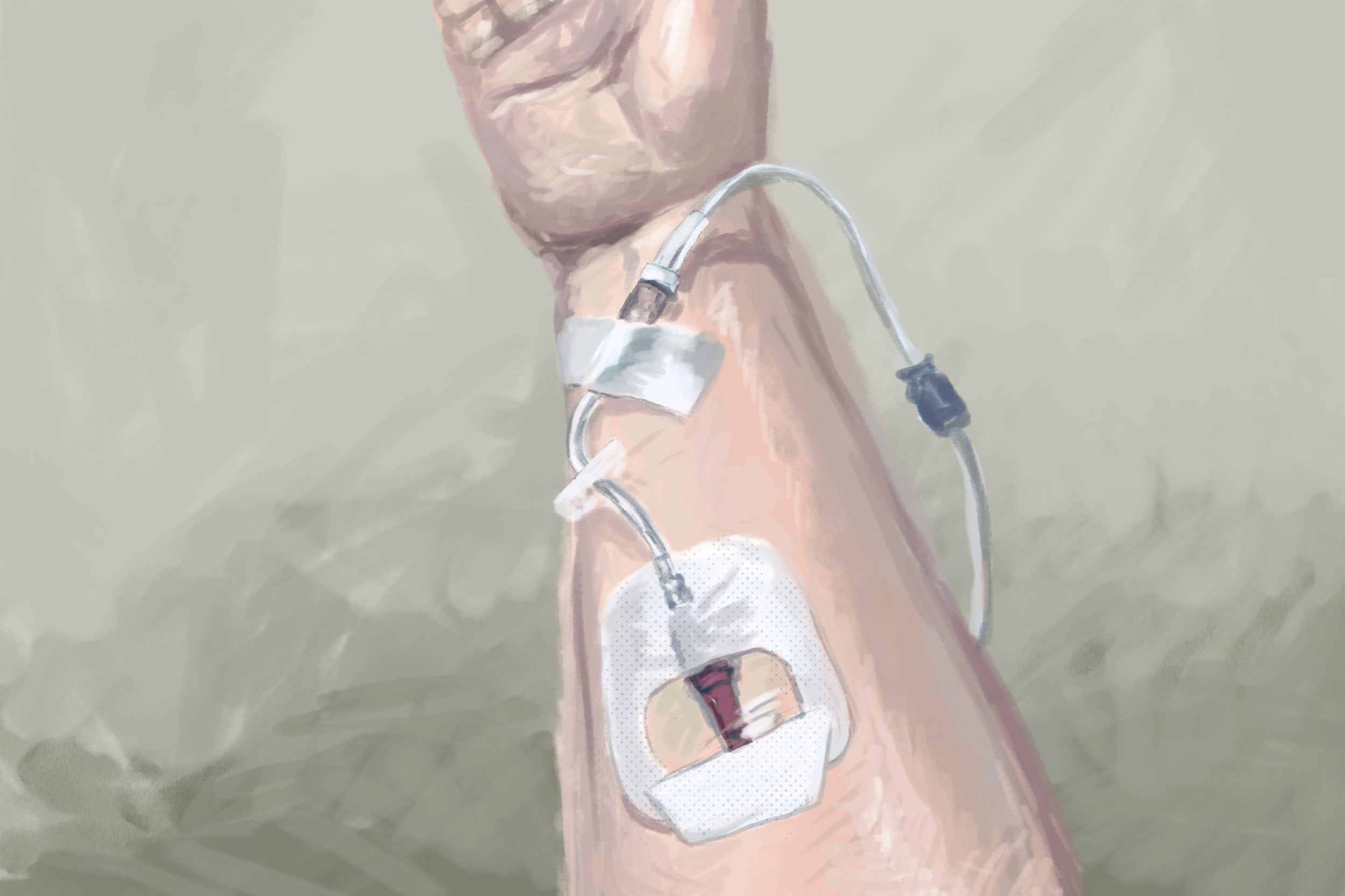 There Might Finally Be a COVID Solution for Immunocompromised People Like Me