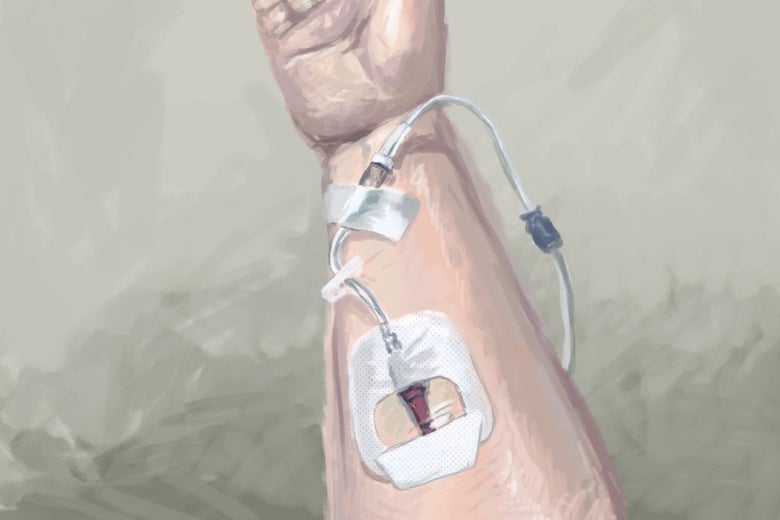 There Might Finally Be a COVID Solution for Immunocompromised People Like Me There Might Finally Be a COVID Solution for Immunocompromised People Like Me