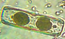 A living diatom found in the sample