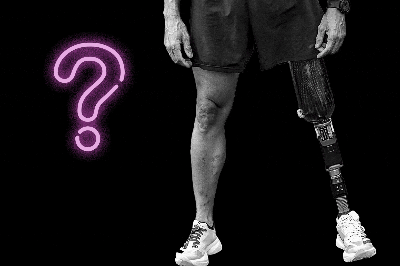 Sex Advice I Have To Get My Leg Amputated It s Complicating My Dating sex-advice-i-have-to-get-my-leg-amputated-it-s-complicating-my-dating