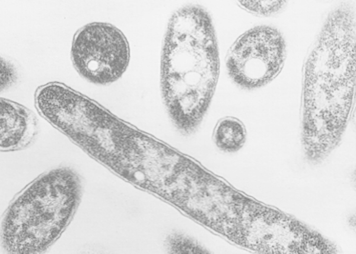 New York Legionnaires' outbreak: Bacteria detected in cooling systems ...