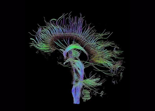 Reconstructed fiber tracts that run through the mid-sagittal plane in a visualization of a DTI measurement of a human brain.