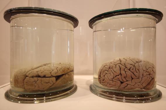 Preserved brains are displayed at the new 'Brains' exhibition at the Wellcome Collection on March 27, 2012 in London, England. 