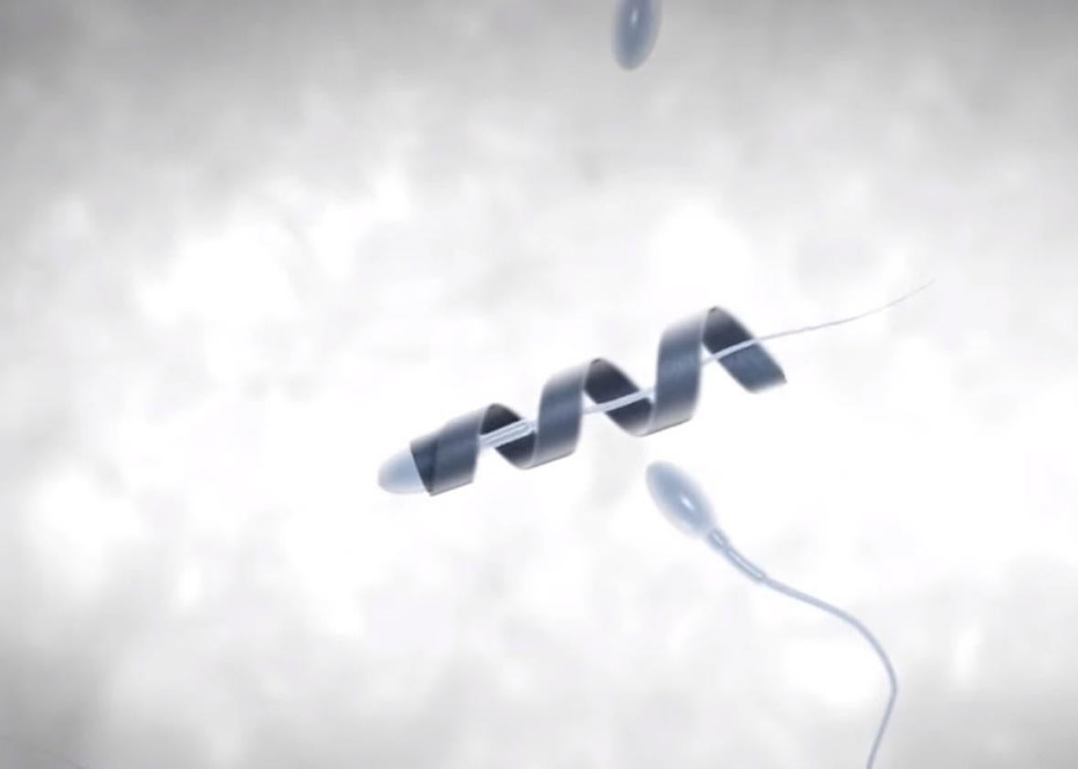 Sperm nanobot