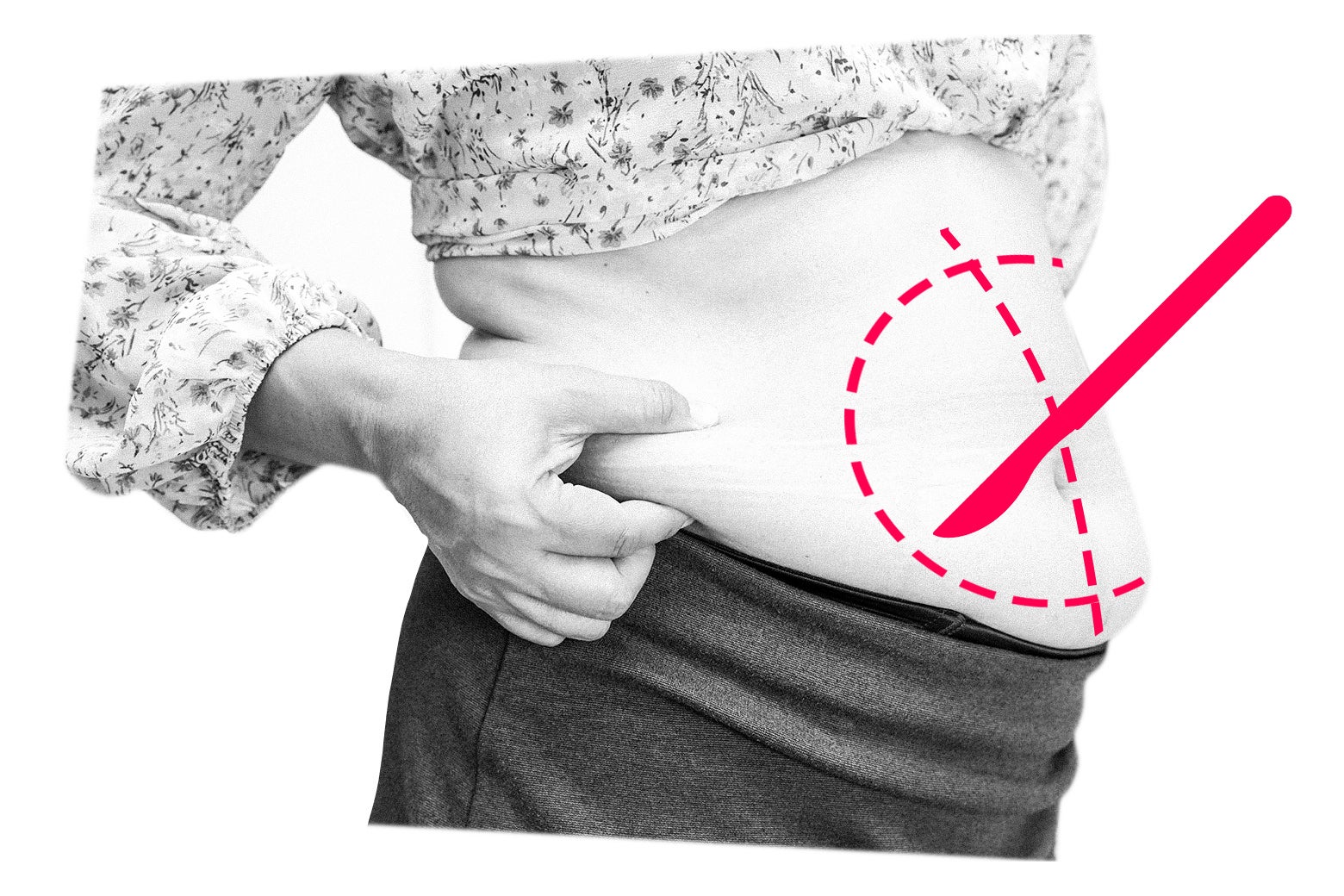 Help! I Desperately Need Plastic Surgery. My Husband&rsquo;s Reaction Has Thrown Me for a Loop.