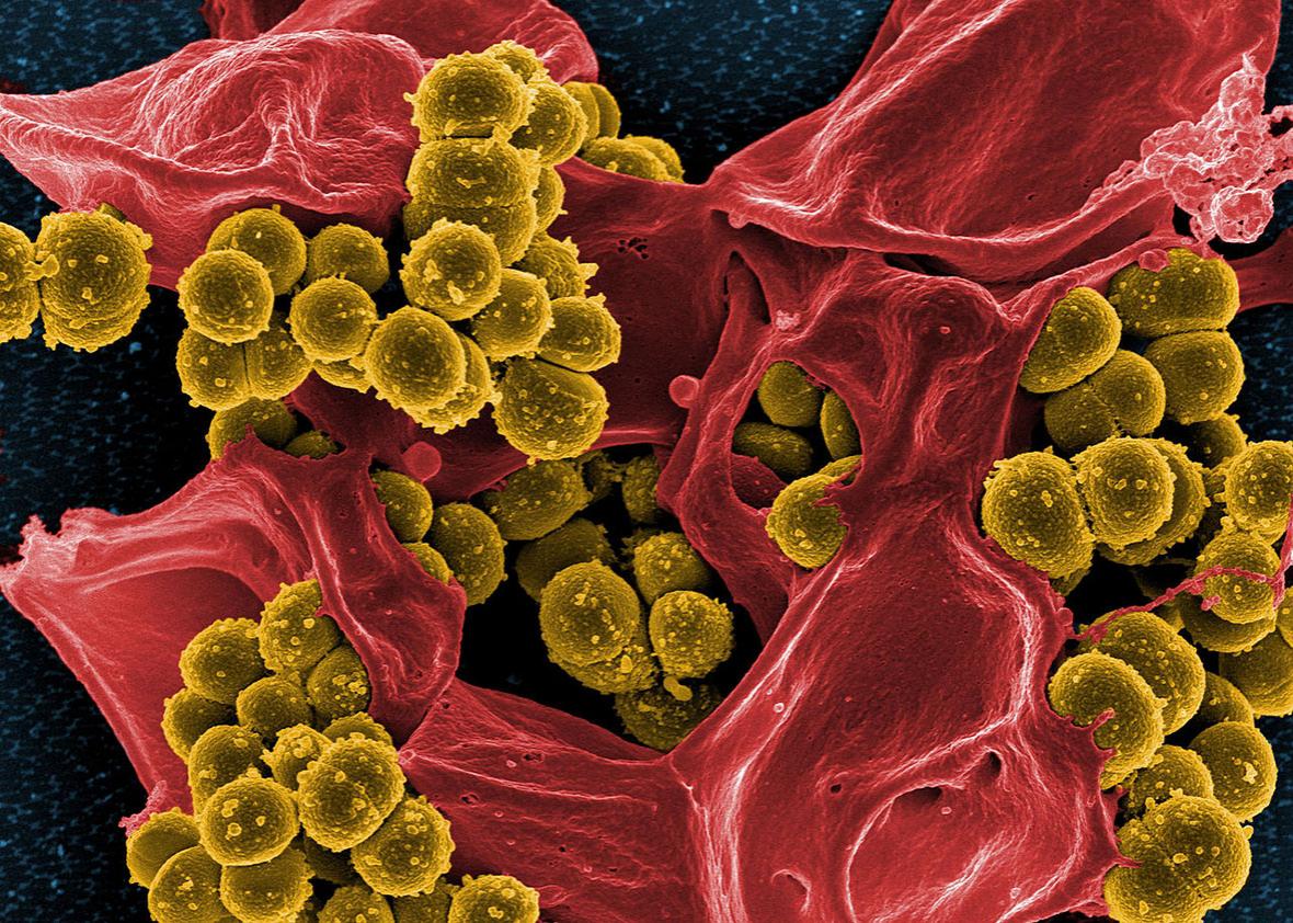 Staphylococcus aureus antibiotic resistant.