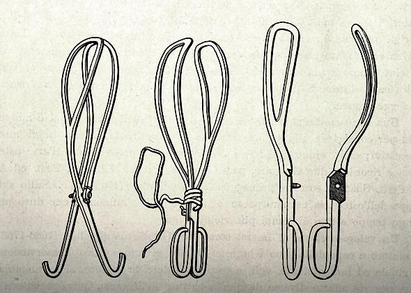 A medical engraving from The Chamberlens and the Midwife Forceps (by H. Aveling) illustrates tools used to assist childbirths in the early 1880s.
