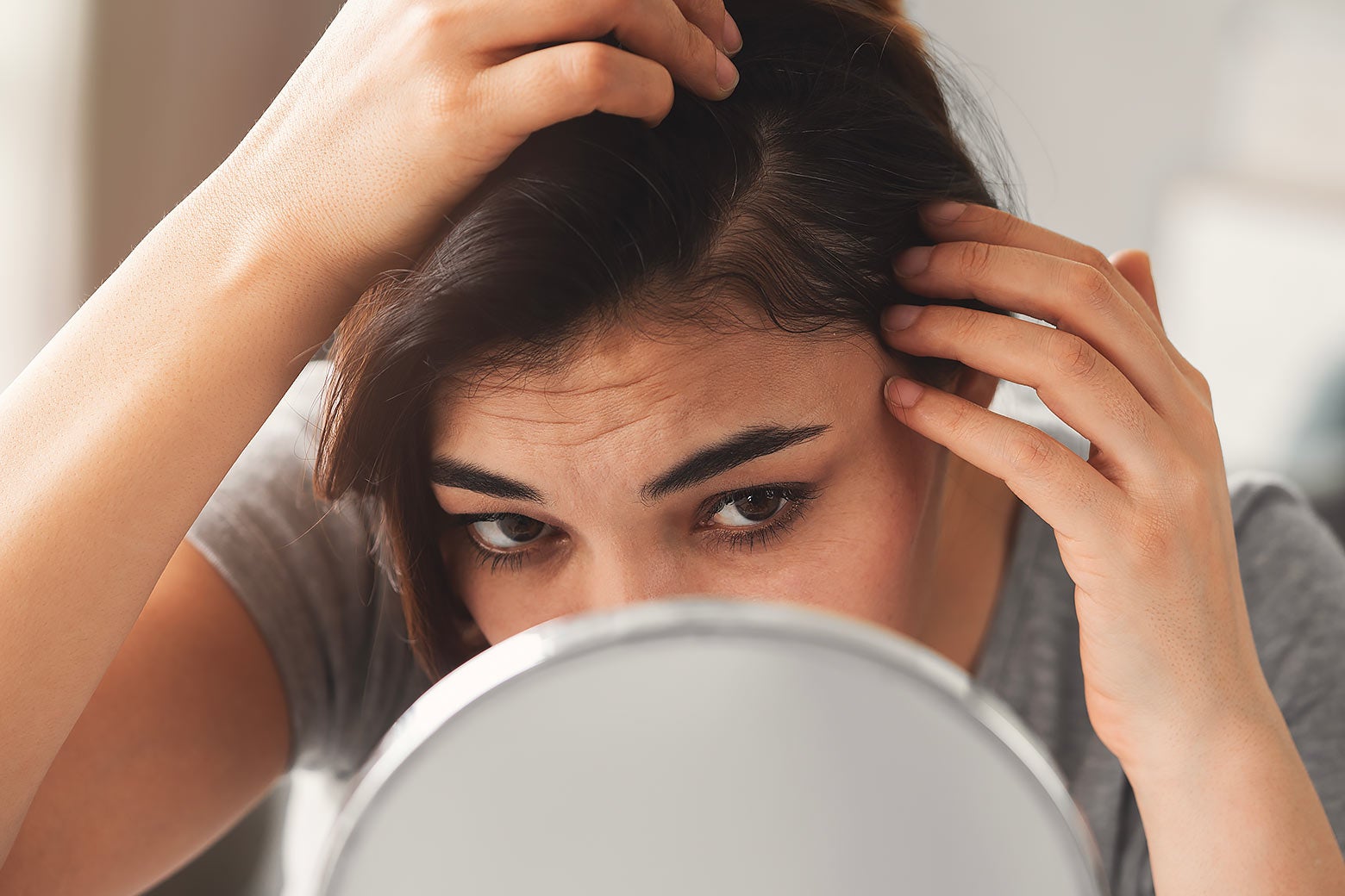 I'm 25, and I Have a Cosmetic Problem That No One Wants-and That's Maddening to Fix.